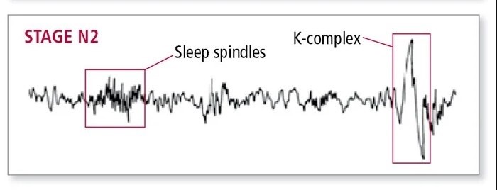 الگویی به نام K-complex